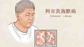 为什么中档酒店赛道只跑出了亚朵？